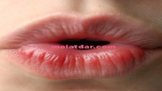 دراسة جديدة: القبلة تساعد على علاج فقدان الشهية