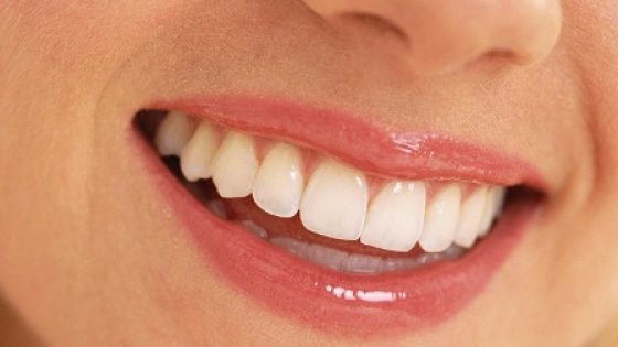 تبييض الاسنان بالكركم في مدة قصيرة