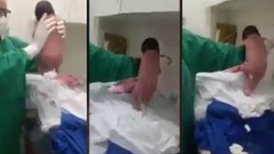 بالفيديو… رضيعة تمشي بعد دقائق من ولادتها وسط دهشة الممرضين