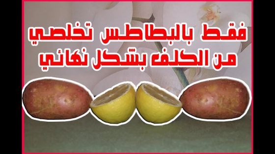 بحبة بطاطس واحدة تخلصي من الكلف بشكل نهائي